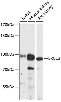 Anti-ERCC3 Antibody (CAB12702)