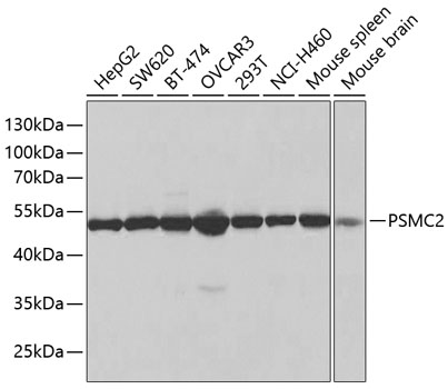 Anti-PSMC2 Antibody (CAB1985)