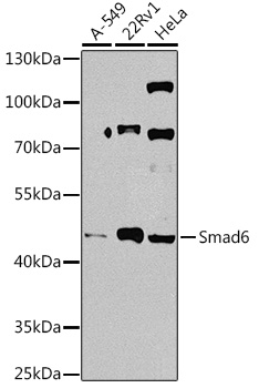 Anti-Smad6 Antibody (CAB14749)