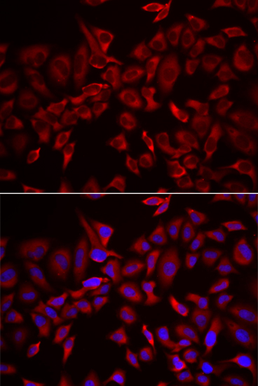 Anti-CSRP3 Antibody (CAB13372)