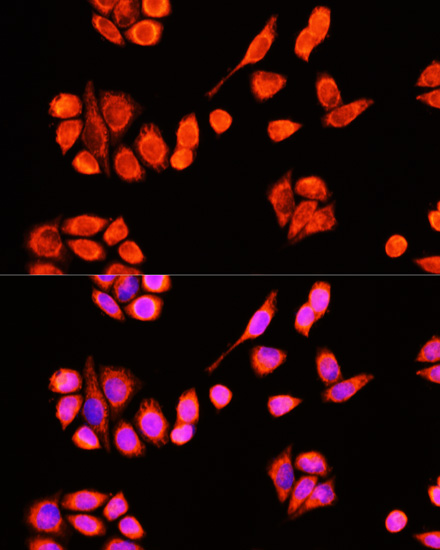 Anti-DNAJC19 Antibody (CAB14961)