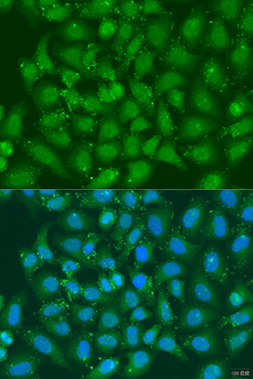 Anti-XBP1 Antibody (CAB1731)