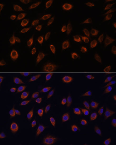 Anti-NTPCR Antibody (CAB14944)