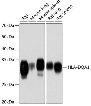 Anti-HLA-DQA1 Antibody