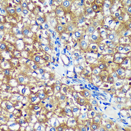 Anti-PYCR2 Antibody (CAB15155)