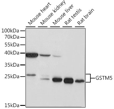 Anti-GSTM5 Antibody (CAB15677)