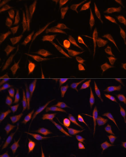 Anti-PTCD1 Antibody (CAB16219)