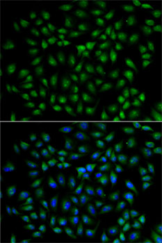 Anti-RBPJ Antibody (CAB5675)