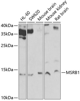 Anti-MSRB1 Antibody (CAB6737)