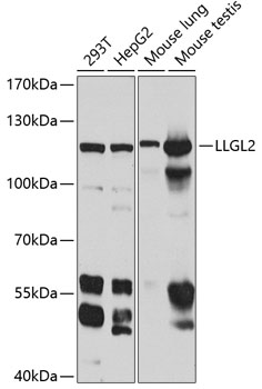 Anti-LLGL2 Antibody (CAB8099)