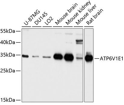 Anti-ATP6V1E1 Antibody (CAB3756)