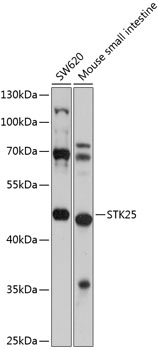 Anti-STK25 Polyclonal Antibody (CAB9726)