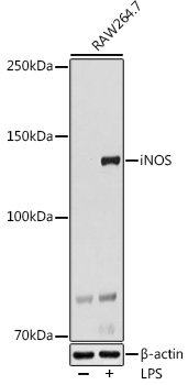 Anti-iNOS Antibody (CAB3200)