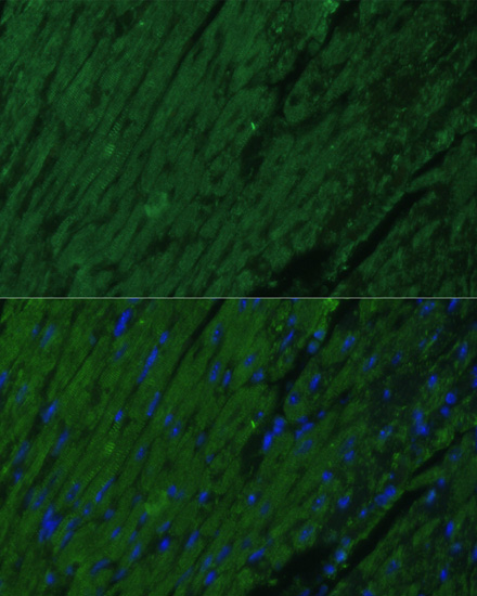 Anti-TNNI3 Antibody (CAB6995)