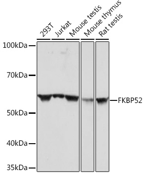 Anti-FKBP52 Antibody (CAB4356)