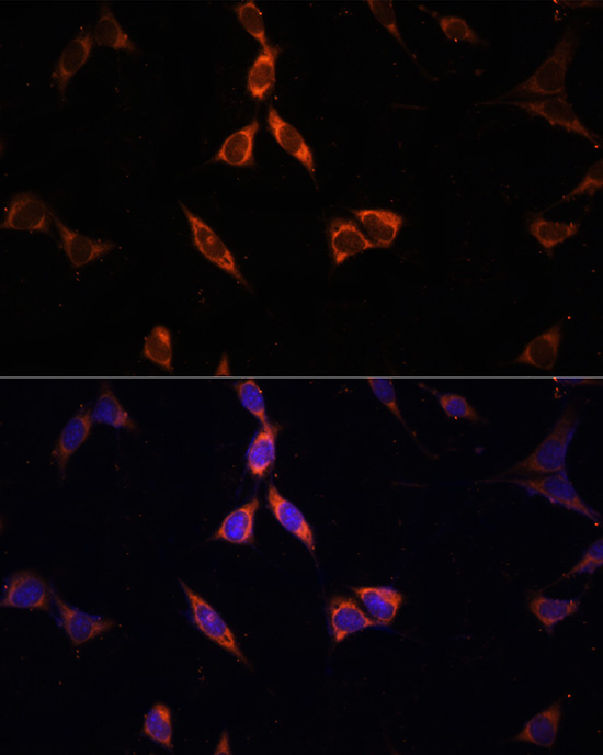 Anti-ACSS2 Antibody (CAB6472)