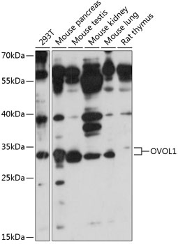 Anti-OVOL1 Antibody (CAB14379)