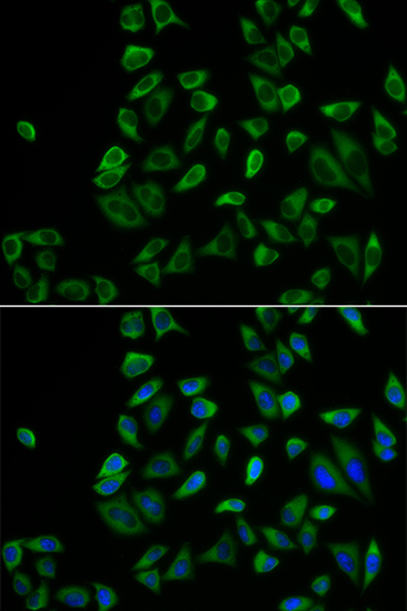 Anti-PEX5 Antibody (CAB5780)