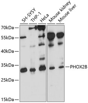 Anti-PHOX2B Polyclonal Antibody (CAB9685)