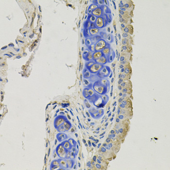 Anti-Gephyrin Polyclonal Antibody (CAB8572)