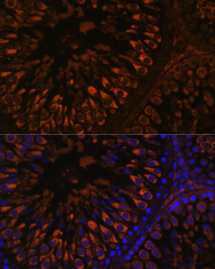 Anti-FER1L5 Antibody (CAB15926)