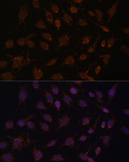 Anti-ACAT1 Antibody (CAB13273)