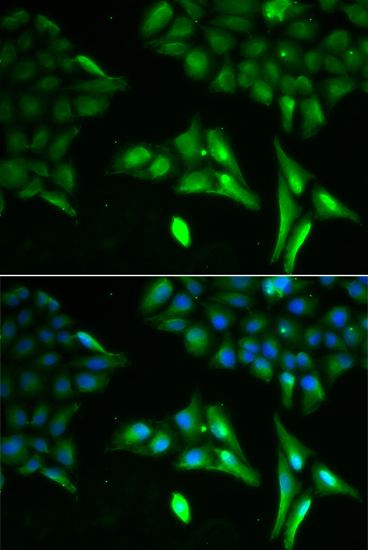 Anti-ACADS Antibody (CAB0945)