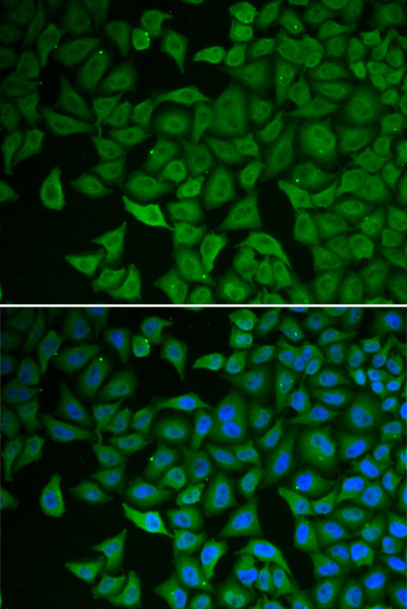 Anti-Chk2 Antibody (CAB0466)