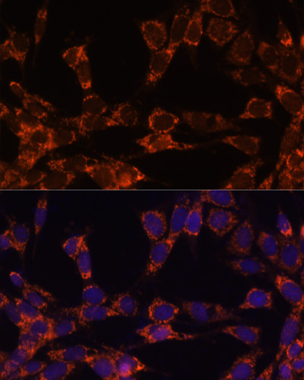 Anti-UBE2F Antibody (CAB5160)