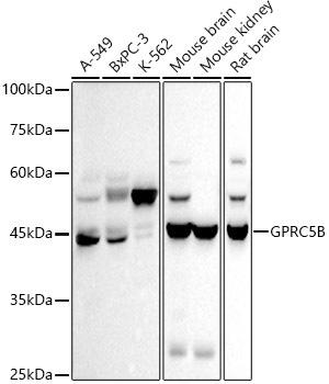 Western blot analysis of extracts of various cell lines, using GPRC5B antibody at 1:500 dilution. Secondary antibody: HRP Goat Anti-Rabbit IgG (H+L) at 1:10000 dilution. Lysates/proteins: 25ug per lane. Blocking buffer: 3% nonfat dry milk in TBST. Detection: ECL Basic Kit. Exposure time: 30s.