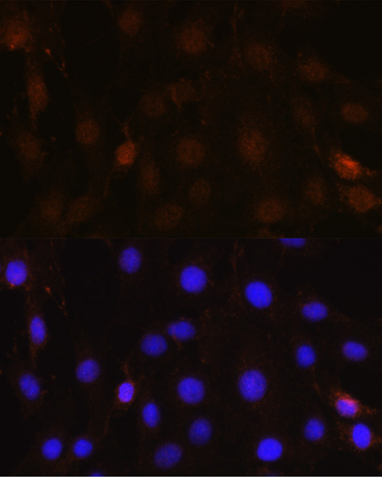 Anti-NRBF2 Antibody (CAB13422)