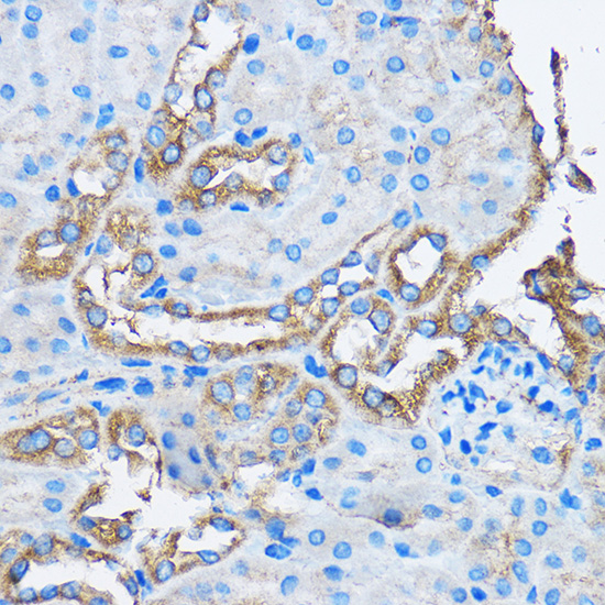 Anti-CAPZA2 Antibody (CAB2054)