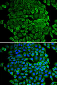 Anti-Cytochrome c Antibody (CAB0225)