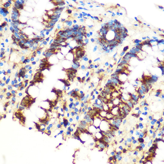 Anti-SAV1 Antibody [KO Validated] (CAB18667)