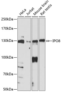 Anti-IPO8 Antibody (CAB14679)