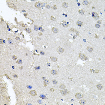 Anti-PKN1 Antibody (CAB0553)