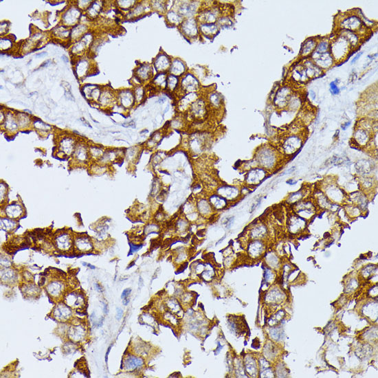 Anti-SEPT4 Antibody (CAB10238)