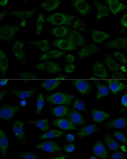 Anti-NDUFB7 Antibody (CAB13693)