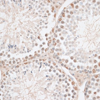 Anti-HMGN1 Antibody (CAB14646)