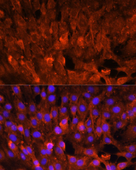 Anti-CISH Antibody (CAB14527)