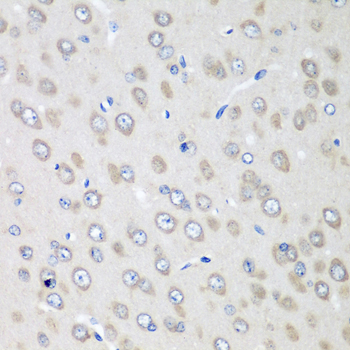 Anti-RPN2 Polyclonal Antibody (CAB8352)