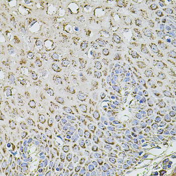 Anti-TMC1 Polyclonal Antibody (CAB8595)