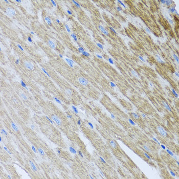 Anti-Metaxin-2 Polyclonal Antibody (CAB7958)