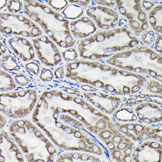 Anti-Tubulin alpha 1b Antibody (CABC024)