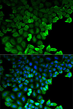 Anti-G6PD Antibody (CAB13983)