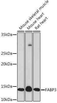 Anti-FABP3 Antibody (CAB8789)