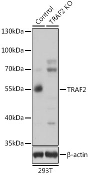 Anti-TRAF2 Antibody [KO Validated] (CAB0962)