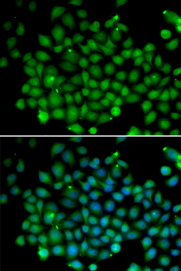 Anti-UBD Antibody (CAB13397)