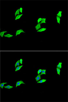 Anti-MB Antibody (CAB13326)