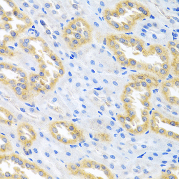 Anti-BMP3 Antibody (CAB6877)